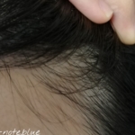 洗い方検証arau編・頭皮6プッシュ＋髪は2プッシュを複数回×1度洗いの3日目(実質4日目)の首の後ろ、うなじ付近の様子。フケが出ている